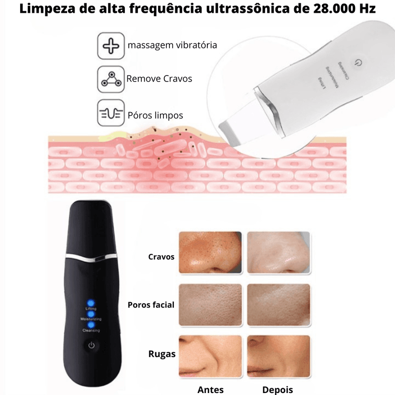 Espátula Peeling Ultrassônico-Para Cravos - TUDO QUE EU SONHEI